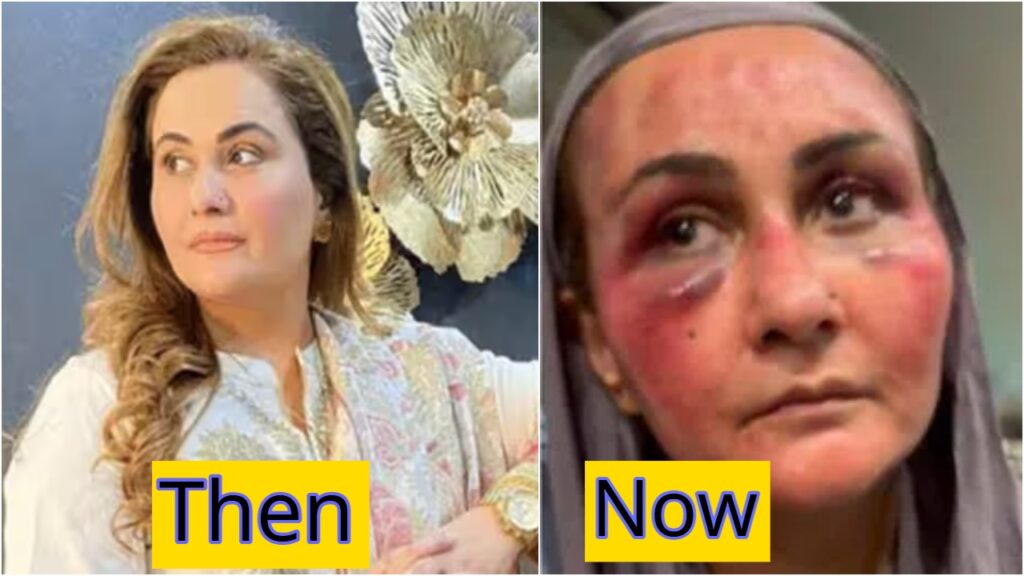 pakistani actress gazala idress torture